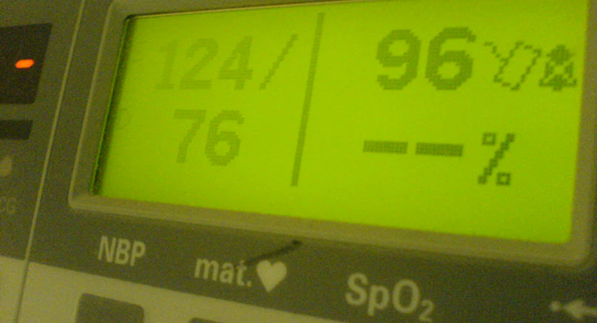 Hospital monitor