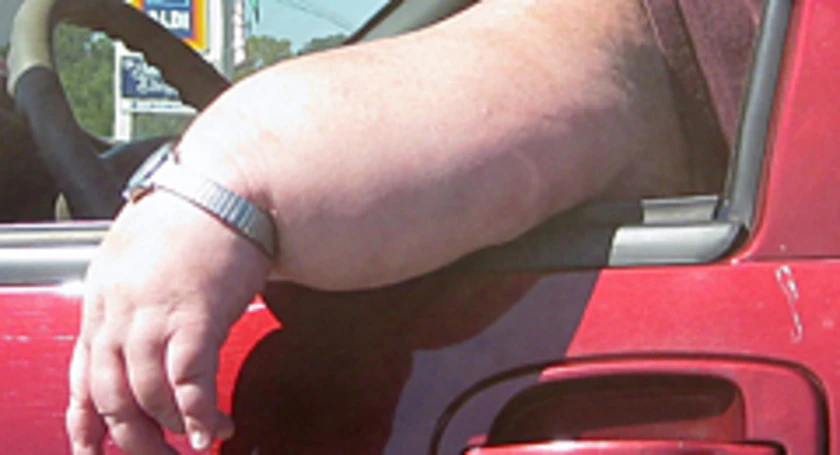 Fat arm wrist