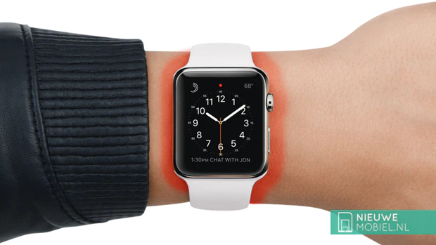 Apple Watch burns Apple Watch burns