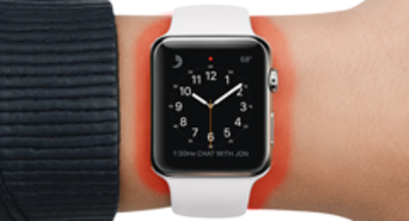 Apple watch burn marks
