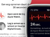 Apple Watch Ecg Recording