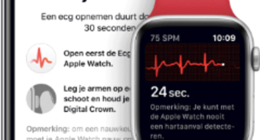Apple watch ecg recording