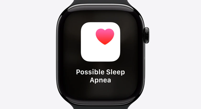 Apple watch possible sleep apnea