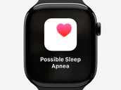 Apple Watch Possible Sleep Apnea