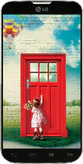 LG L70 Dual (D325)